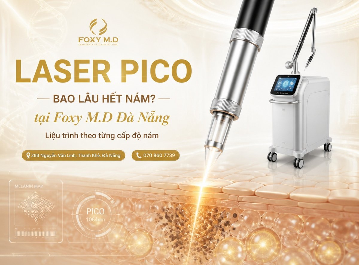 Bắn Laser Pico bao lâu hết nám? Phân tích liệu trình theo từng cấp độ nám da