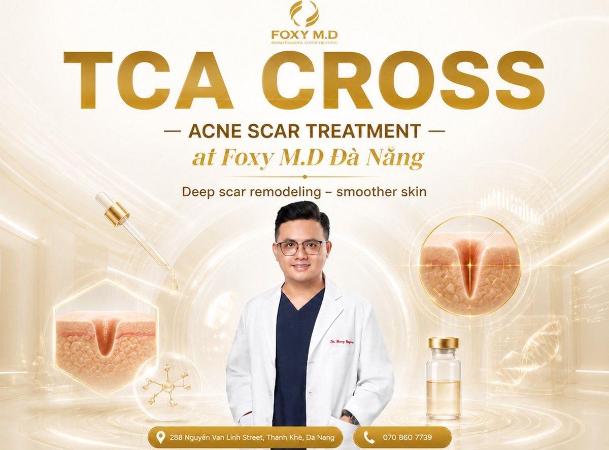 TCA Cross for ice-pick scars: Prices & the technique for closing deep scar pits