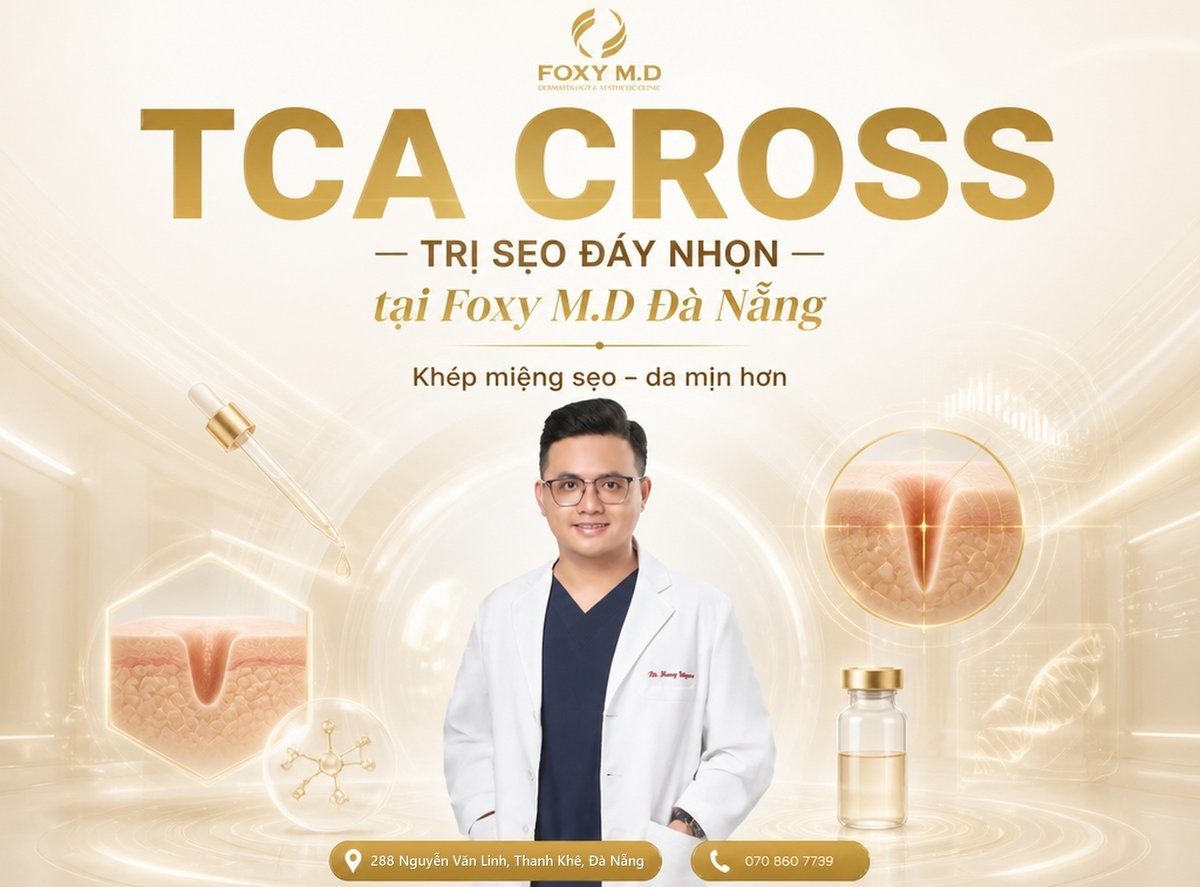 Chấm TCA Cross trị sẹo đáy nhọn (Ice-pick): Bảng giá & kỹ thuật khép miệng hố sẹo sâu