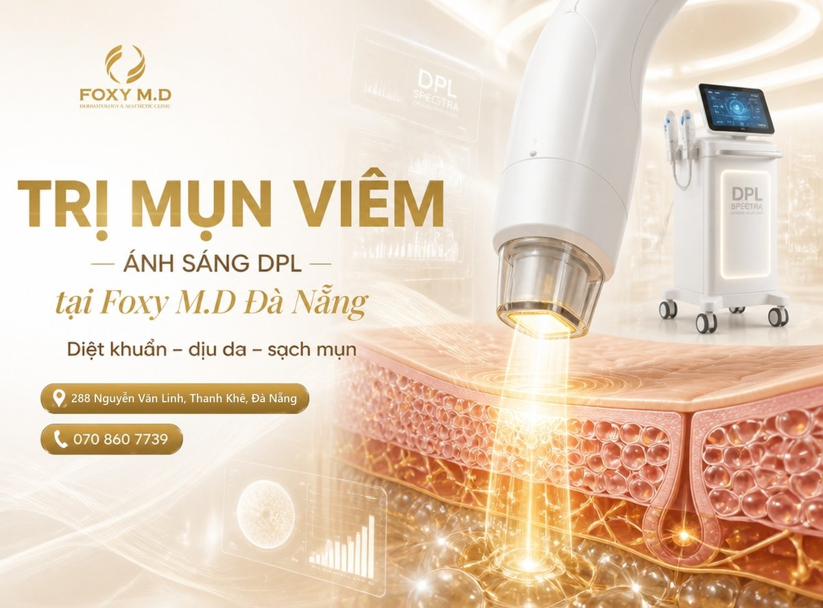 Điều trị mụn bằng ánh sáng DPL
