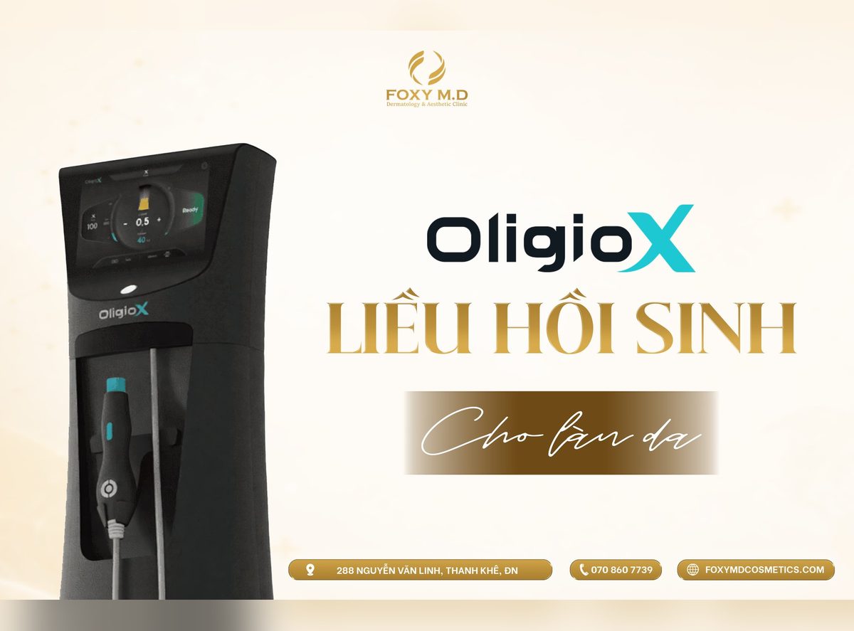 Nâng cơ Oligio X tại Đà Nẵng
