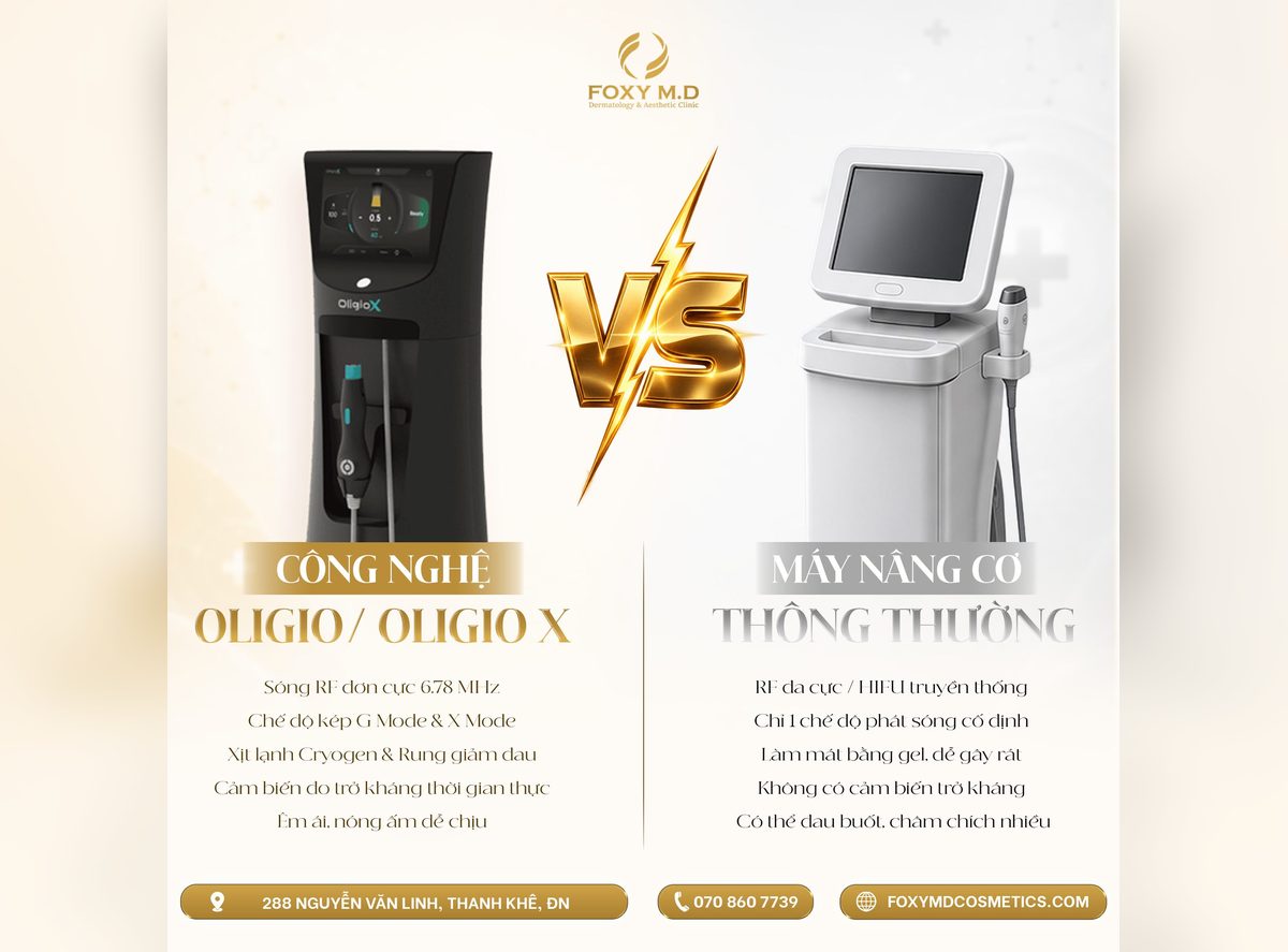 So sánh công nghệ Oligio X với máy nâng cơ thông thường tại Foxy M.D