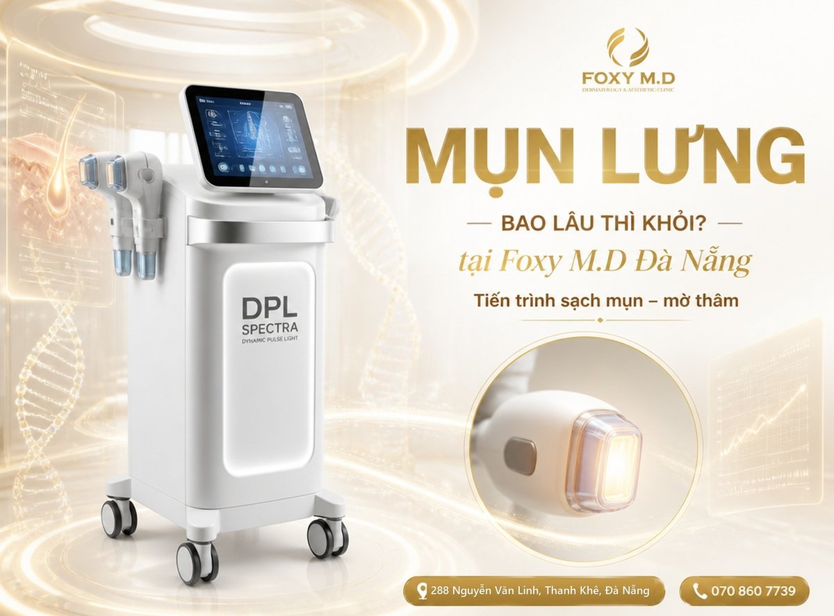 Trị mụn lưng bao lâu thì khỏi? Phân tích tiến trình dứt điểm mụn và mờ thâm