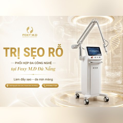 Điều trị sẹo rỗ chuẩn y khoa tại Đà Nẵng: Phác đồ đa công nghệ