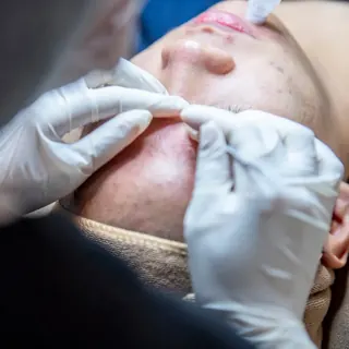 Quy trình chăm sóc da chuẩn y khoa